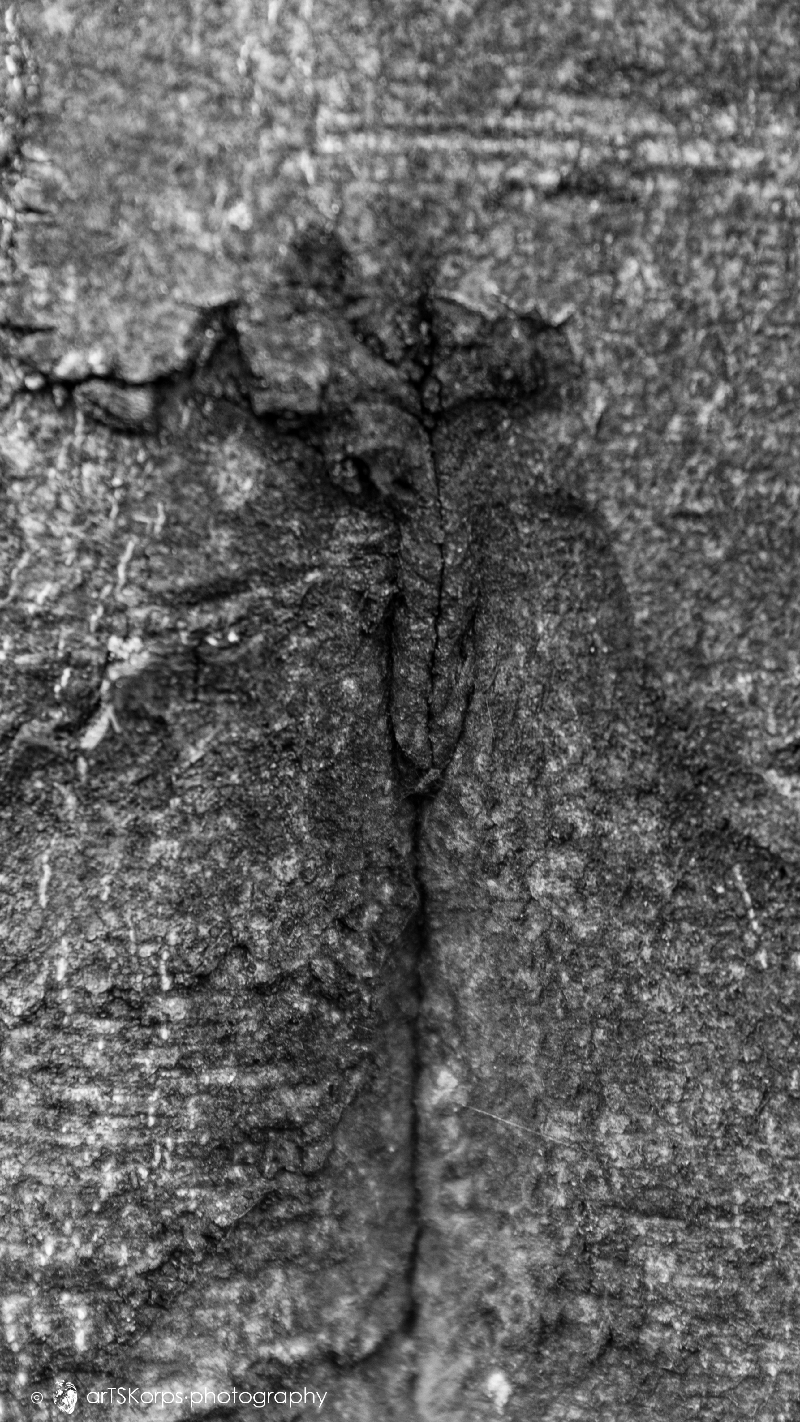 sutured